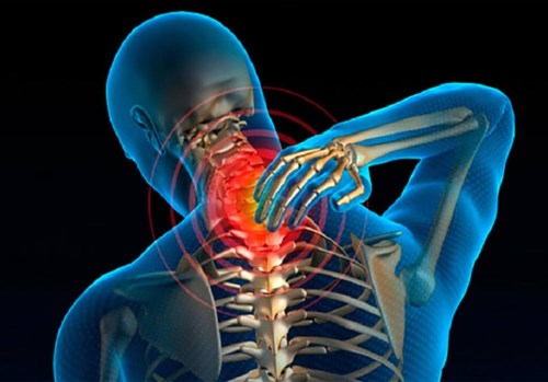 گردن درد و شیوه های درمان خانگی 